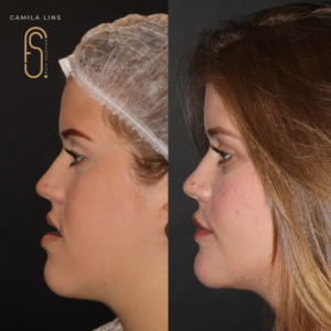 Beige-Minimalist-Skincare-Before-and-After-Instagram-Post-1-1.png