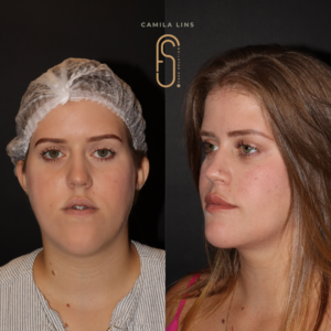 Beige-Minimalist-Skincare-Before-and-After-Instagram-Post-2.png