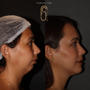 Beige-Minimalist-Skincare-Before-and-After-Instagram-Post-5.png