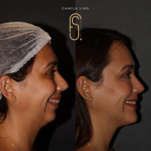 Beige-Minimalist-Skincare-Before-and-After-Instagram-Post-6.png