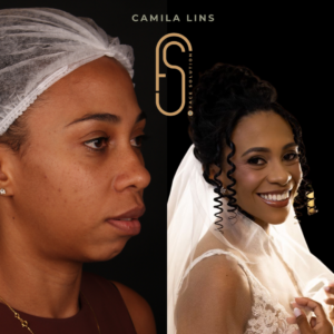 Beige-Minimalist-Skincare-Before-and-After-Instagram-Post-9.png